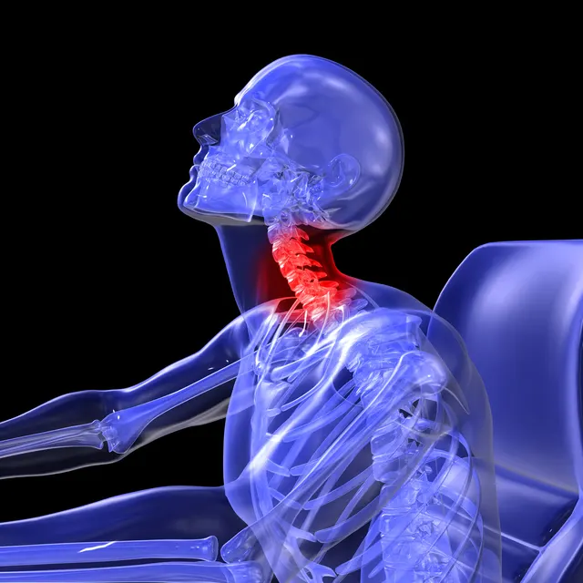 Richmond Neck Injury Lawyer near me