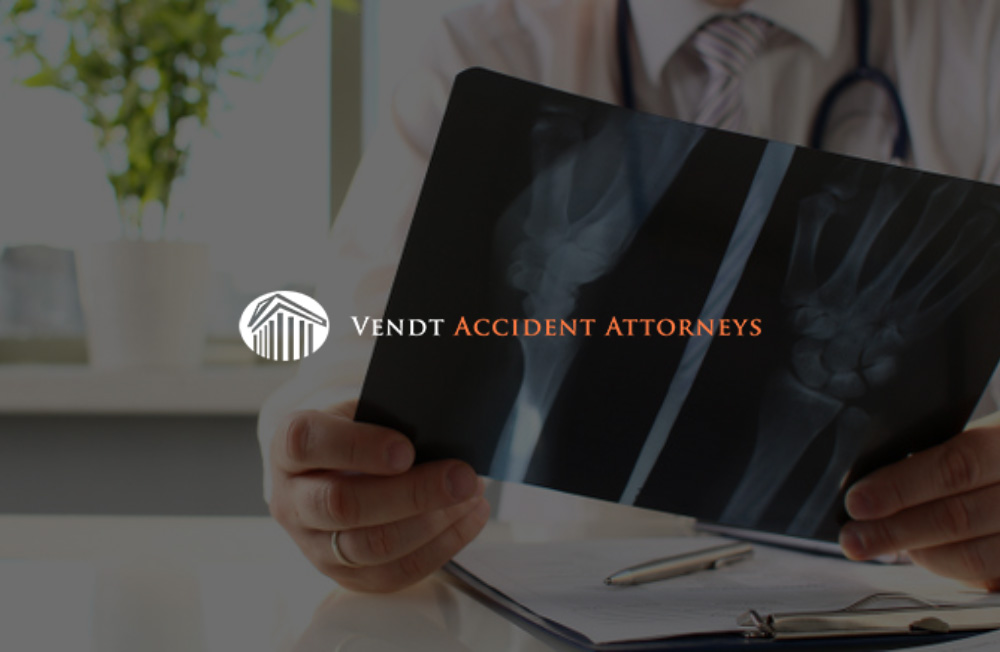 Richmond soft tissue injury attorney